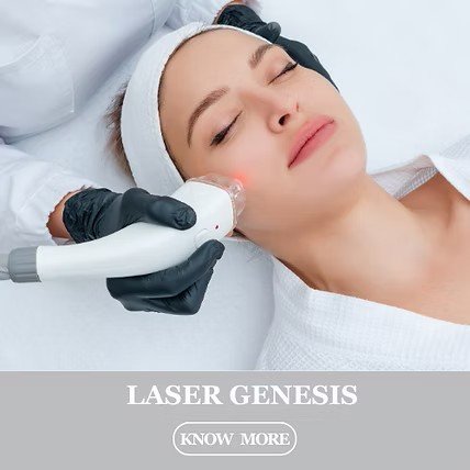 Laser Genesis