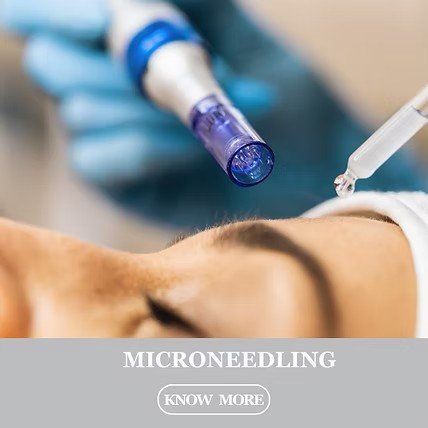 Microneedling